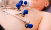 Ecocardiograma
