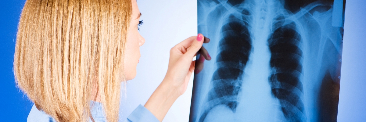 https://www.saludemia.com/documents/425003/439517/dia+mundia+cancer+pulmon/1eedb1ca-074f-48d5-9c35-3cb242b422ce?t=1416232408951